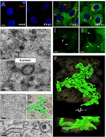 FIG 5 Nucleocapsid protein-containing structures are intertwined with EAV-induced replication structures