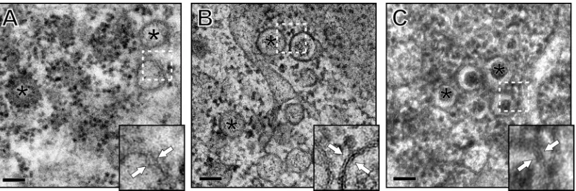 FIG 2 Comparison of DMV morphology after different ﬁxation procedures. EAV-infected Vero E6 cells were ﬁxed at 7 h p.i