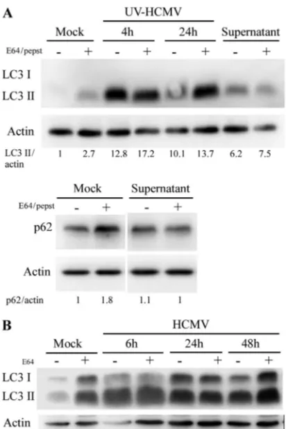 FIG 2 (A) Supernatant of HCMV-infected cells is able to stimulate autophagy.MRC5 cells were treated during 4 h with supernatant of HCMV-infected cellsclariﬁed of viral particles and cellular debris by ultracentrifugation (see Mate-rials and Methods) or inf