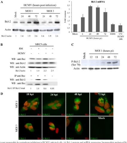 FIG 4 Bcl-2 is not responsible for autophagy inhibition in HCMV-infected cells. (A) Bcl-2 protein and mRNA expression