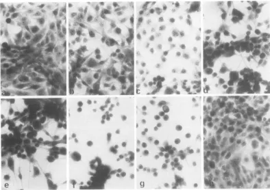 FIG.s~ts339(RSV)NRKhematoxylinthe(g)Thesethe1. Morphological changes in ts339(RSV)NRK cells after a shift from 39 to 33°I
