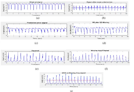 Table 1 represents the performance parameters obtained by proposed methodology. Total 21 ECG signal tested here which includes 9 males of age group 53-77 and 12 females of age group 32-89
