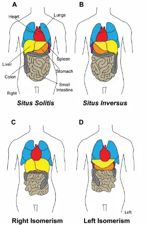 Figure 1- 1) LR asymmetric organ placement and morphology is vital for human health 