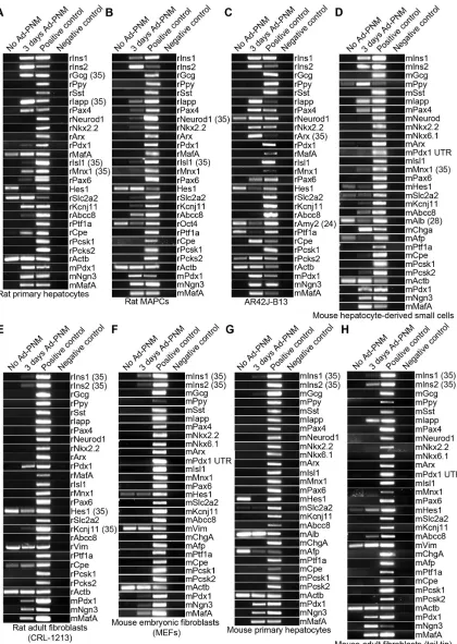 Figure 1.  bands in the first two lanes of mouse fibroblast the effect of Expression of various beta cell genes provoked by transduction with Ad-PNM