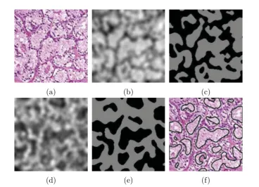 Figure 2.5: Illustration of the texture-based k-means clustering segmentation in [35] (a) RGBimage of the glands