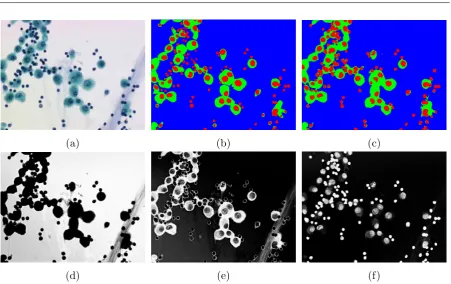 Figure 2.8: Illustration of the SVM probability based watershed segmentation in [57] (a) Orig-inal image