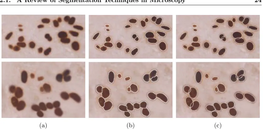 Figure 2.19: Segmentation results of the ellipsoidal model-based watershed algorithm in [52](a) Original cervical and breast cell images with clustered nuclei