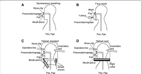 Figure 1 Schematic representation of the experimental design. (A) Spontaneous breathing; (B) face mask; (C) helmet standard; (D) helmetnext