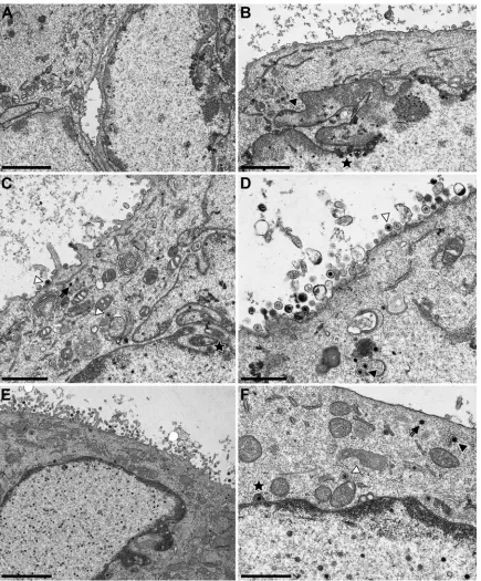 FIG 6 Ultrastructural analysis of TM substitutions. RK13-UL34-LBRTM (A and B), RK13-UL34-EMDTM (C and D), and RK13-UL34-LapTM (E and F) wereinfected with PrV-�UL34 at an MOI of 1 and processed for electron microscopy 14 h after infection