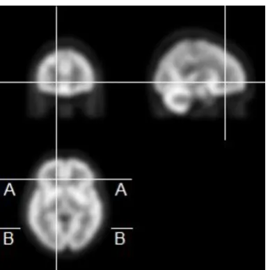 Figure 6  Coronal, sagittal and axial slices from the smoothed source data. The 