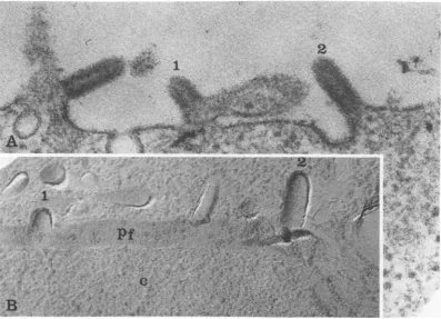 FIG.1.particle.sectionedfractured Budding of VSV as seen by ultrathin sectioning and freeze-fracturing