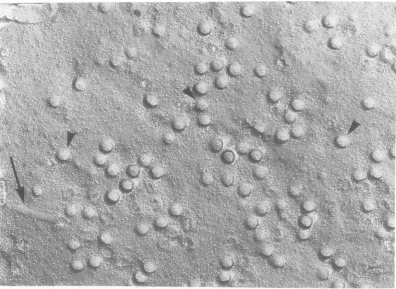 Fig. 3. The arrowheads point out a few viral structures that appear to have intramembranal particles