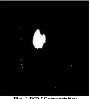 Fig. 3 K Means Clustering  