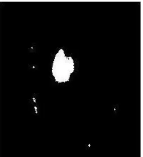 Fig. 6 Output Images of Tumor Area Estimation  