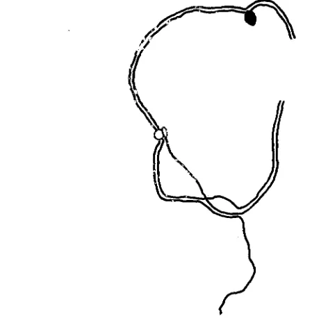 FIGURE 4.-Camera in juxtaposition with the two insertion regions of the normal chromosomes