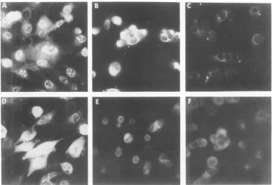 FIG.1.9serumwithafter Tu Patterns ofIF staining observed in HSV-2-infected, virus-transformed and normal hamster cells treatment with anti-VP143 and anti-HSV-2 sera