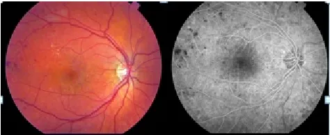 Fig. 2 Shows Difference between Orginal Picture and Compacted picture   