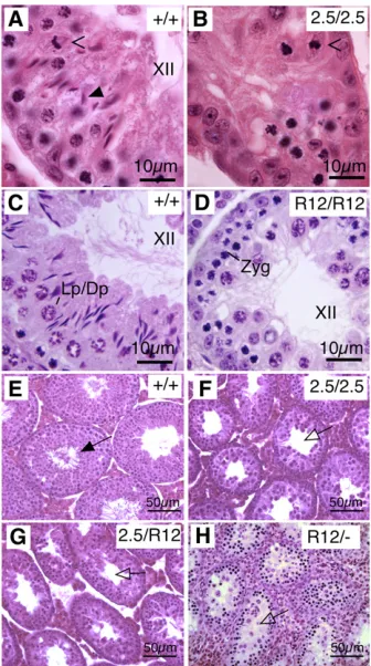 Figure 1 Mutations in(2.5/2.5, B) has metaphase structures (open arrowhead) but lacks consis-tent evidence of spermiogenesis.cross-sections from aesis as evidenced by the mature spermatozoa in the lumen of the tubule(black arrow)