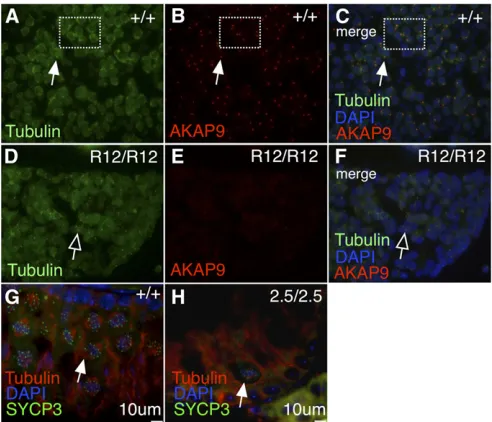 Figure 2 Mutation inRTa 495-bp amplimer in wild-type (+/+) andAKAP9 protein expression in pancreas and testis showsseveral protein species centered at 250 kDa in wild-type (+/+) animals, which is absent in R12/R12 andcauses defective splicing at the 3and n