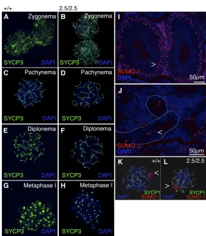 Figure 4 Akap9 mutant males exhibit normal spermato-cyte progression through prophase I but irregular primaryspermatocyte localization but successful central elementformation during pachynema