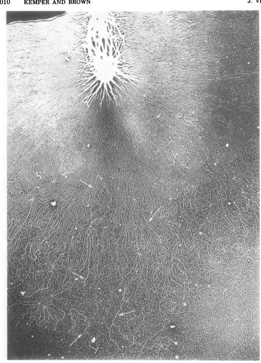 FIG.7.DNAdark-field Demonstration of supercoiled portions in the VFS-DNA. VFS-DNA isolated as membrane-free from T4 amE727 (gene 49)-infected cells was spread and visualized in the electron microscope under conditions