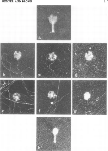 FIG. 9.Magnification,Examplesofincreasing(h) VFS-DNA Electron microscopic examination ofpartially filled DNA-attached heads