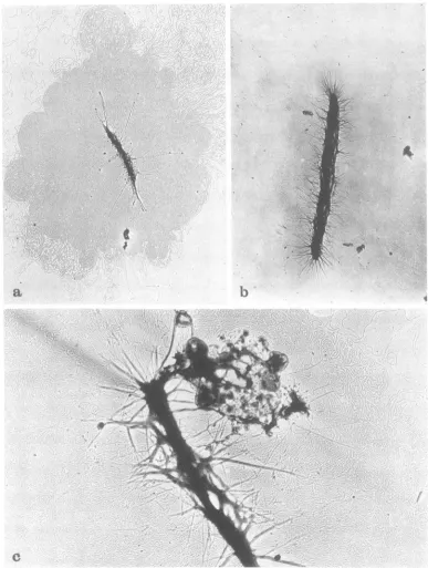 FIG.4.Magnification,fromandMembrane-freeinfectedtion, Visualization of 200S DNA and VFS-DNA in the electron microscope