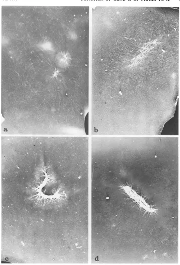 FIG.5.fieldinfectedinfection. Developmental stages of the VFS-DNA as visualized by the electron microscope