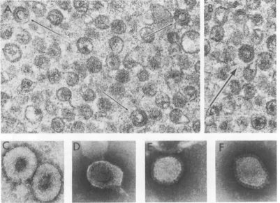 FIG. 7.pigs.(arrows)Thin Electron microscopy of virus particles present in the plasma of leukemic guinea pigs