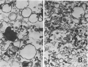 FIG. 3.gradientbrain Electron micrographs ofgradient fractions (7 through 9) of a 1,000 x g, 10-min pellet (A) and of fractions (6 through 10) of an 80,000 x g, 30-min preparation (B) from scrapie-infected hamster (see Fig