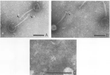 FIG.1.indrop-shaped (B) Pseudomonas phage 2. In (A.) the arrows point to finger-like projections or spikes at the tail tip, and the arrow indicates the shorter spikes