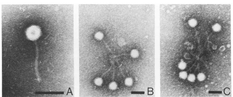 FIG. 3.rosette Phage 2 halo-less mutant pdp (A) after interaction with anti-depolymerase serum (B, C)
