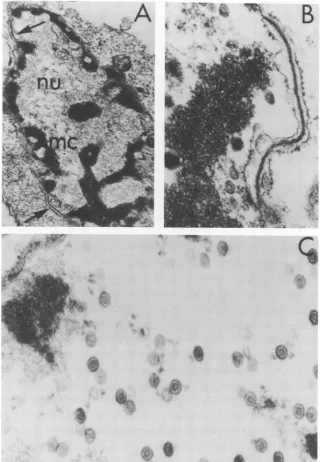 FIG.4.18absencecontainingclassthe h (A) Human embryonic lung (HEL) cell infected with class A mutant tsC2 after 18 h at 38 C