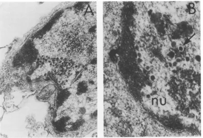 FIG. 6.containingnucleoplasm.infected Human embryonic lung cells infected with DNA- mutant tsB5 after 18 h at 38 C