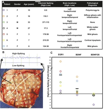 Figure 1 Reciprocal pattern of BDNFand BDNFOS gene expression in electri-cally active human neocortex