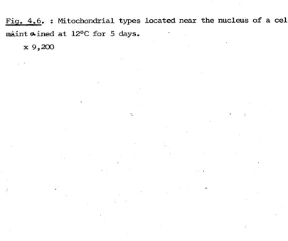 Fig. 4.5. : Cytoplasm of an amoeba cultured at 6°C for 30 days 