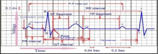 Figure 1 : A General ECG Waveform  