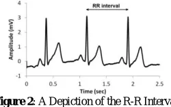 Figure 2 : A Depiction of the R-R Interval  