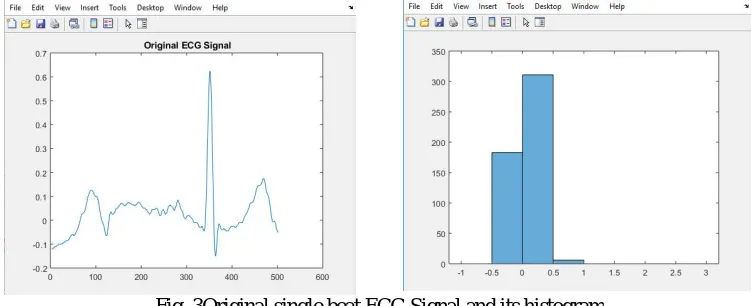 Fig. 3Original single beat ECG Signal and its histogram   