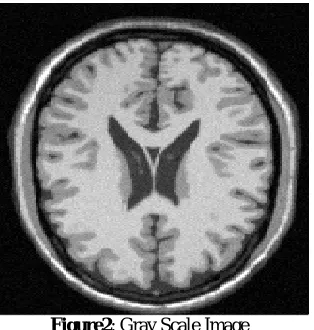 Figure 1: MRI Image 
