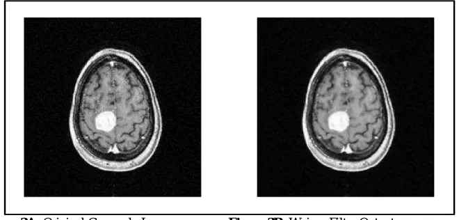Figure 3A: Original Grayscale Image                  Figure 3B: Weiner Filter Output 