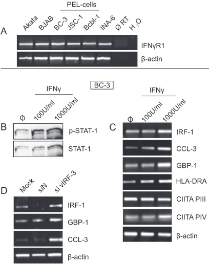 FIG. 6. PEL cells respond to IFN-�BC-3 cells were either left untreated or treated for 24 h with indicatedamounts of recombinant human IFN-lysates were separated by SDS-PAGE and analyzed by Western blot-ting with an antibody to phospho-STAT-1 (Tyr701, uppe