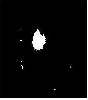 Fig. 6 Output Images Of Tumor Area Estimation  