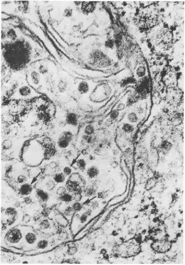 FIG. 6.can Thin section of a virus-induced vesicle at 12 h postinfection. A large number of mature virions (V) be seen in addition to viral nucleocapsids (C); one virion is partially enveloped (E)