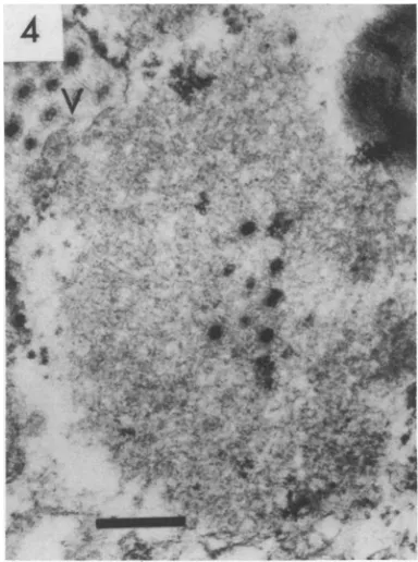 FIG. 2.tracytoplasmic Detail of the edge of a cisterna containing virus. Enveloped particles are situated near an in- mass of convoluted smooth membranes (R)