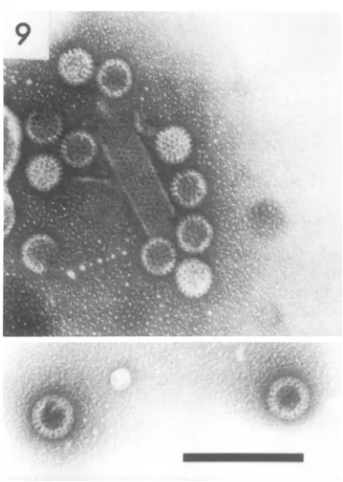 FIG. 9.particlessingle-shelled,spacing,date.invirus. preparations A group of EDIM virus particles, mostly and a tubule with the same subunit 10 nm, as that observed in similar tubules of human duovirus and calf scours The inset shows two typical double-she