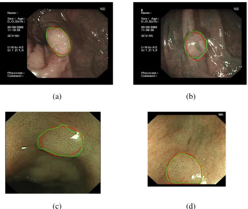 Fig. 10: Our segmentation results for the gPb-OWT-UCMalgorithm [18] for two adenomatous (a) - (b) and two hyper-plastic polyps (c) - (d): In green the manual annotation and inred the gPb-OWT-UCM segmentation is shown.