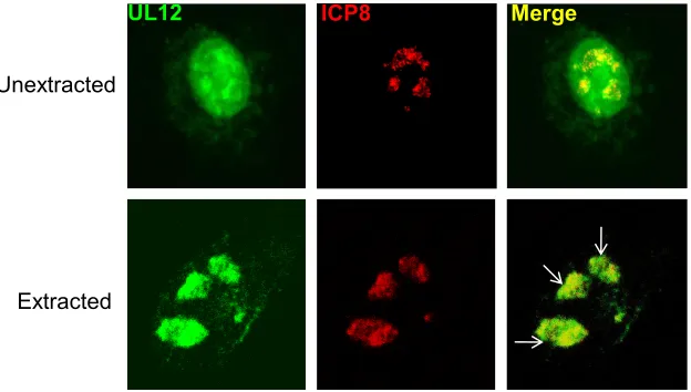 FIG. 1. A subpopulation of UL12 is detergent resistant and localizes to replication compartments