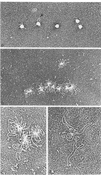 FIG. 9.genomesmallaftercentralisolation:the Electron micrographs of sarcosyl cores prepared by spreading on a protein monolayer at various times isolation