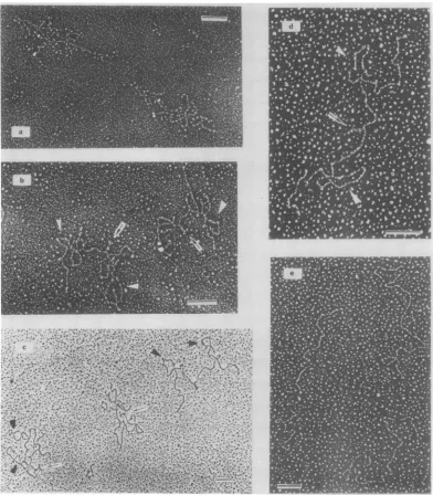 FIG. 3.atindicateurea,temperature 20 Electron micrographs of RD-114 spread by the urea-formamide technique